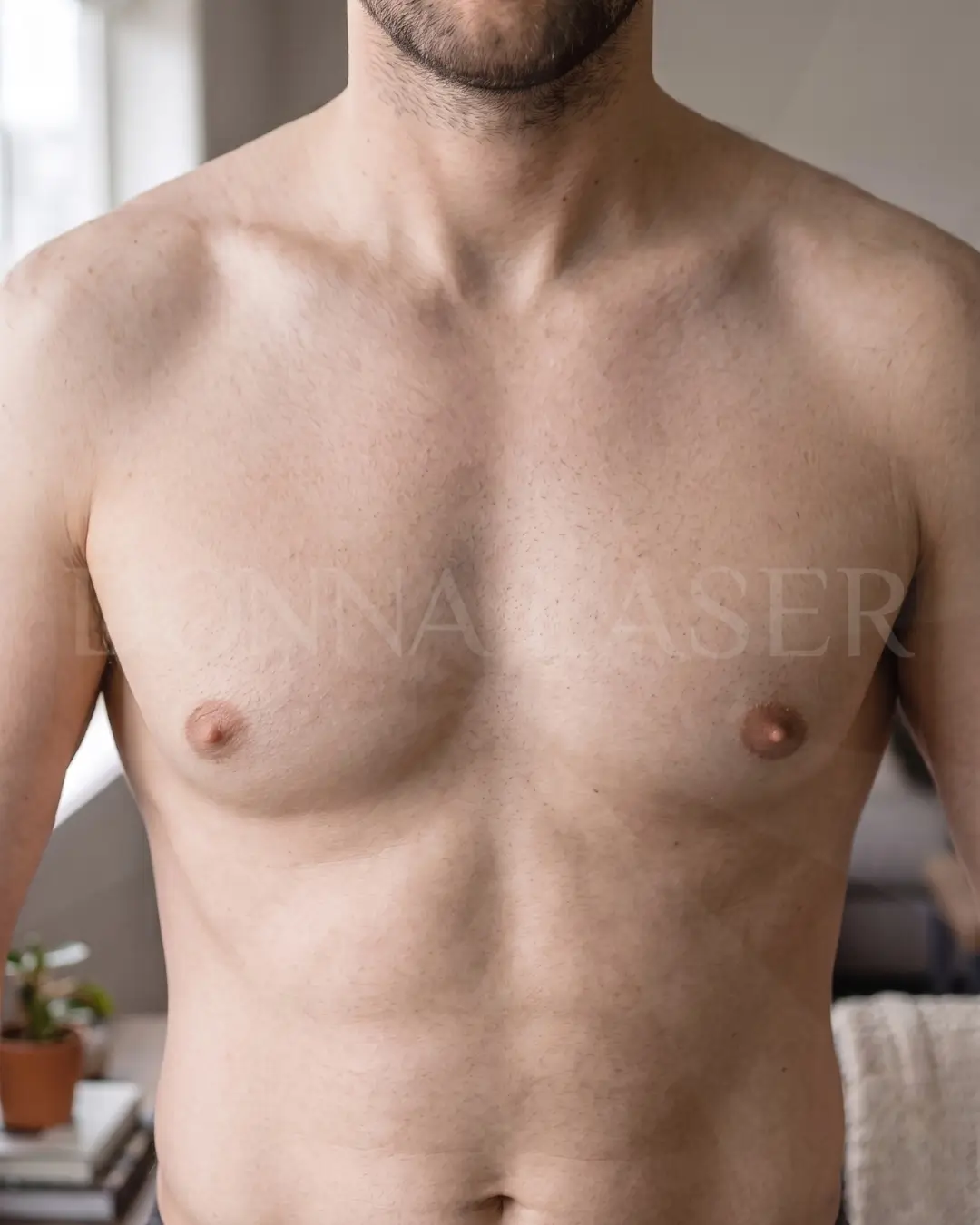 Depois — tórax liso após depilação a laser na Donna Laser